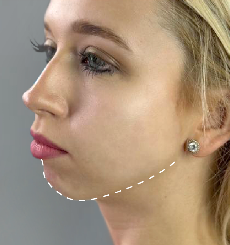 Before - الجلدية