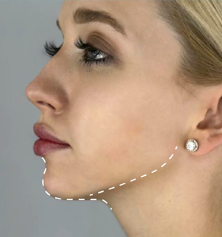 After - الجلدية