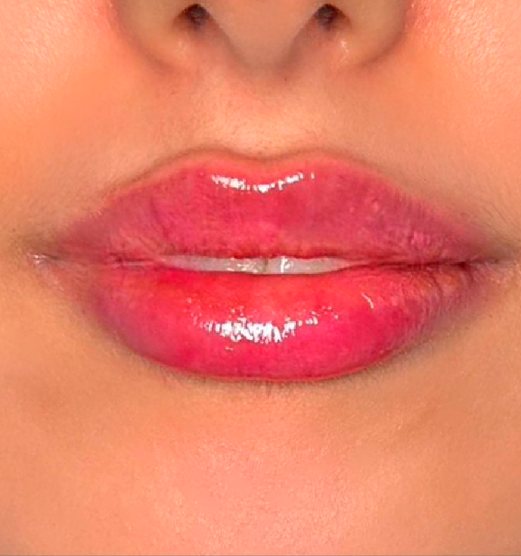 After - الجلدية