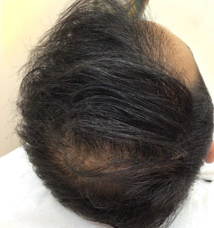 After - الجلدية