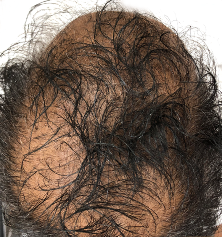 Before - الجلدية