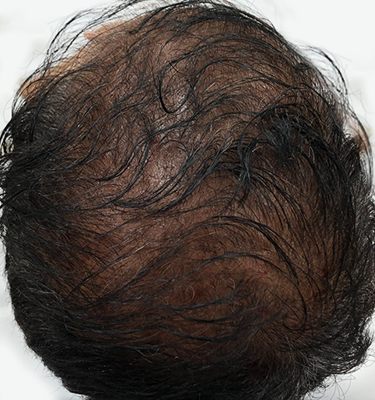 After - الجلدية