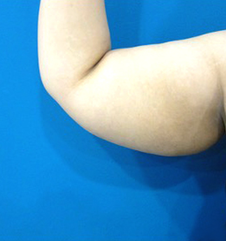 Before - التجميل الجراحي