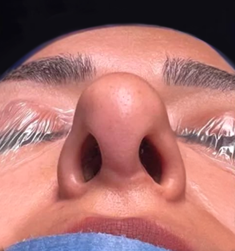 Before - التجميل الجراحي