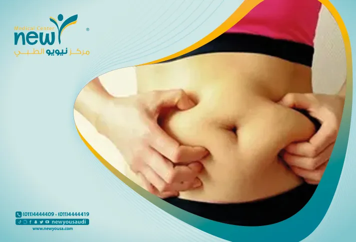 دهون البطن عند النساء كل ما تريدي معرفته عنها من خلال مركزنا الطبي في السعودية | نيويو