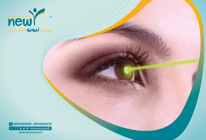 الفرق بين الليزر والليزك كل ما تريد معرفته عنهم من خلال مركزنا الطبي في السعودية | نيويو