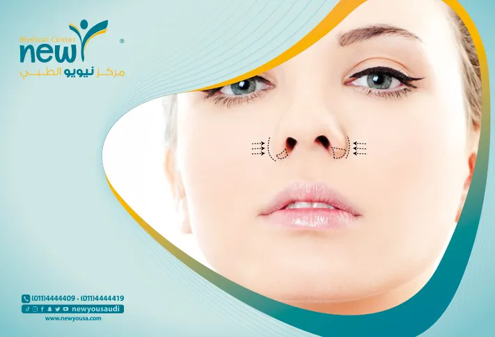 عملية تجميل الأنف كل ما تريد معرفته عنها من خلال مركزنا الطبي في السعودية | نيويو