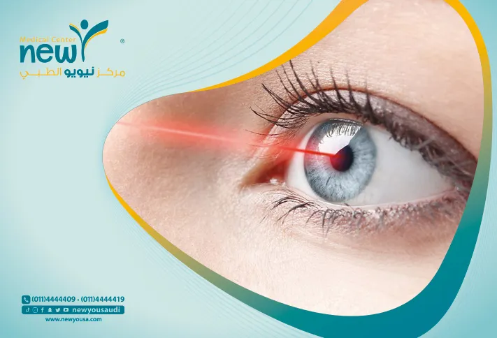 عملية تصحيح القرنية بالليزر كل ما تريد معرفته عنها من خلال مركزنا الطبي في السعودية | نيويو