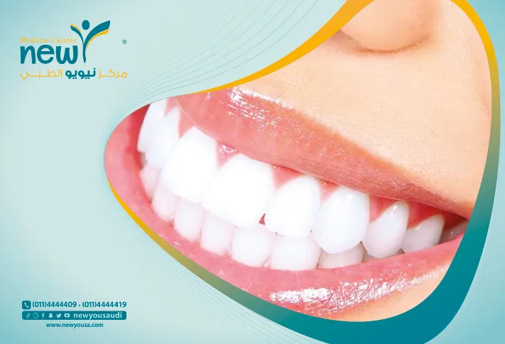 الأسنان الحساسة تعرف عليه من خلال مركزنا الطبي في السعودية | نيويو