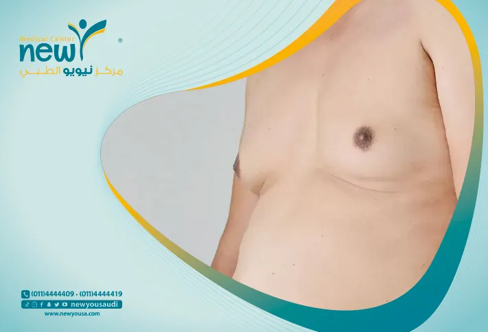 علاج عدم بروز الحلمتين عند الرجال