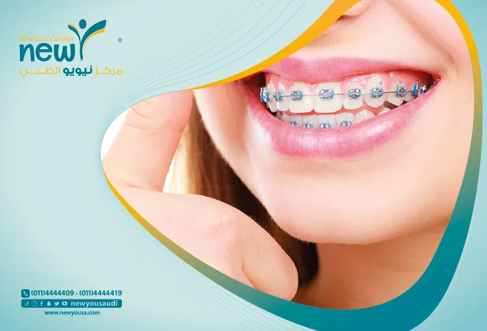 تقويم الانفزلاين كل ما تريد معرفته عنه من خلال مركزنا الطبي في السعودية | نيويو