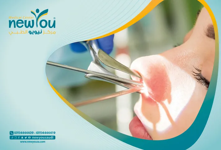 الاستحمام بعد عملية تجميل الأنف كل ما تريد معرفته عنه من خلال مركزنا الطبي في السعودية | نيويو