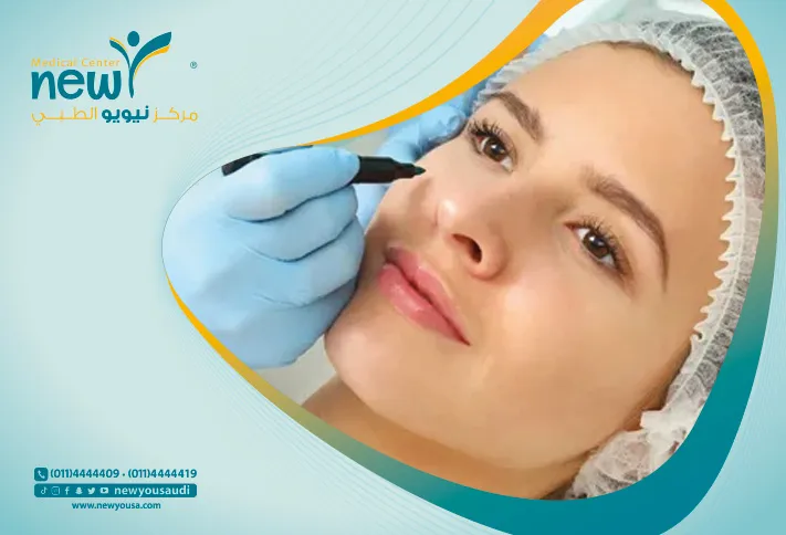 عملية شد الجفون كل ما تريدي معرفته عنها من خلال مركزنا الطبي في السعودية | نيويو
