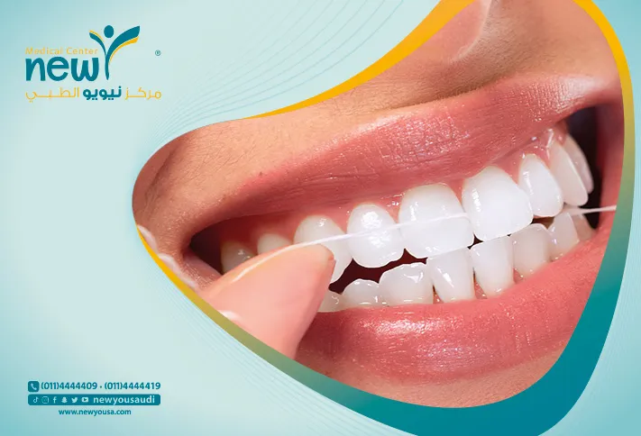 خيط الأسنان كل ما تريد معرفته عنه من خلال مركزنا الطبي في السعودية | نيويو