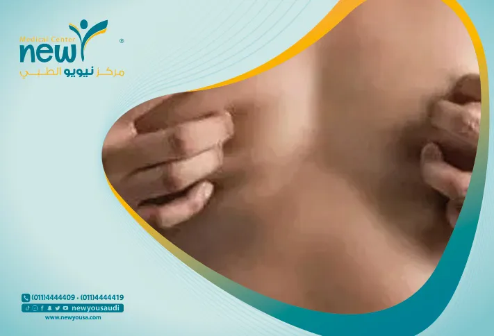 تقنية الفيزر هاي ديف لشفط الدهون وعلاج التثدي كما انها امنه جدا