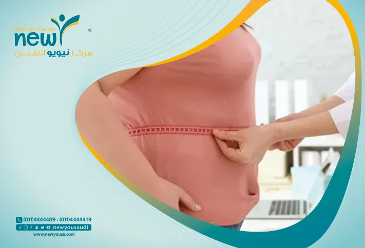 تغيرات في المذاق بعد عمليات جراحات السمنة في السعودية | نيويو