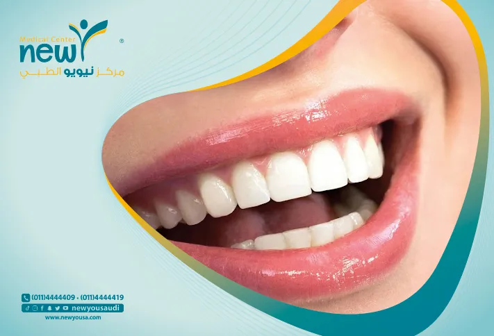 العادات الضارة بالأسنان كل ما تريد معرفته عنها من خلال مركزنا الطبي في السعودية | نيويو