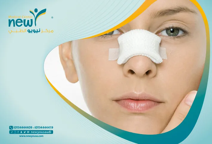 فيلر الأنف كل ما تريد معرفته عنه من خلال مركزنا الطبي في السعودية | نيويو