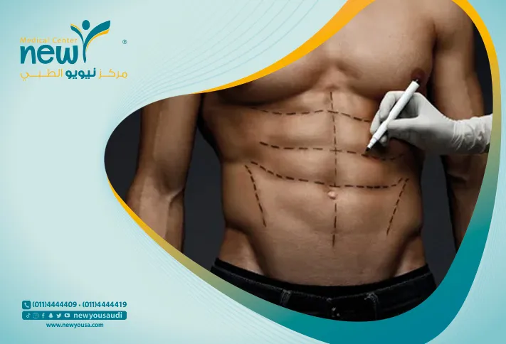 نحت الجسم كل ما تريد معرفته عنه من خلال مركزنا الطبي في السعودية | نيويو