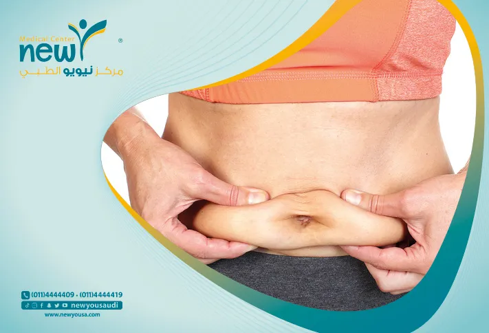 احدث تقنيات شد و صقل الجسم بدون جراحة مع خبرا مركز نيويو الطبي