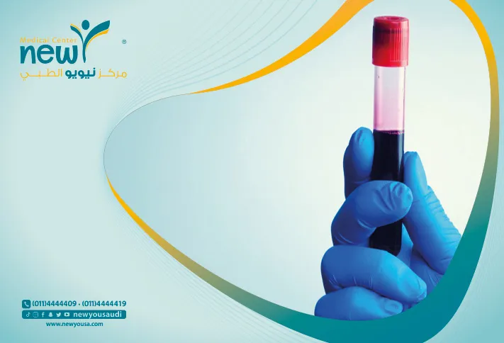 كل ما تريد معرفته عن العد الدموي من خلال مركزنا الطبي في السعودية | نيويو