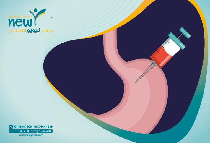 حقن بوتوكس المعدة كل ما تريد معرفته عنها من خلال مركزنا الطبي في السعودية | نيويو