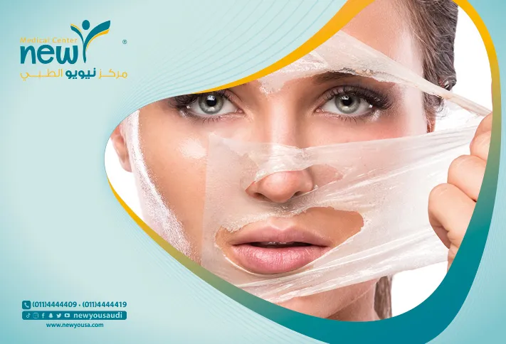 التقشير الكريستالي تعرف عليه من خلال مركزنا الطبي في السعودية | نيويو