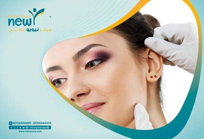 عملية تجميل الأذن كل ما تريد معرفته عنها من خلال مركزنا الطبي في السعودية | نيويو