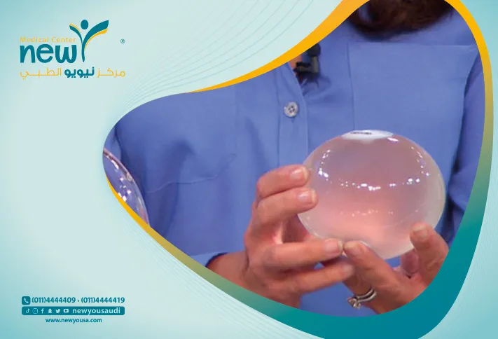 تعرف علي عملية البالون الذكي من خلال مركزنا الطبي نيويو