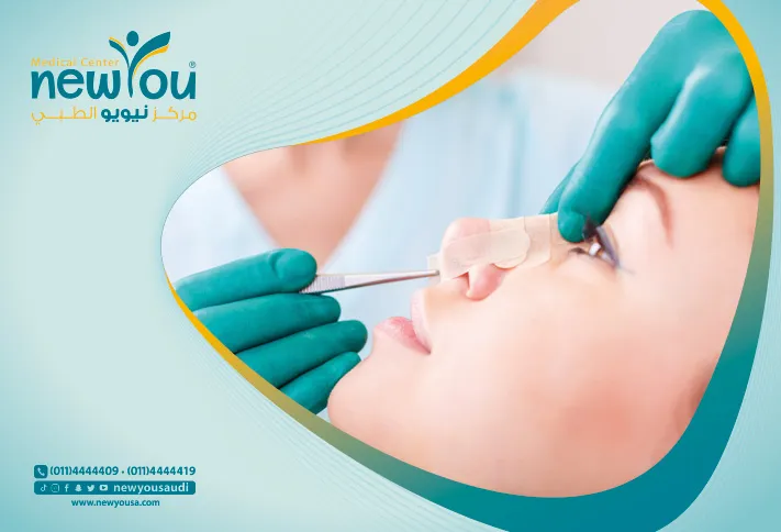 ما هي مخاطر فيلر الأنف - نيويو