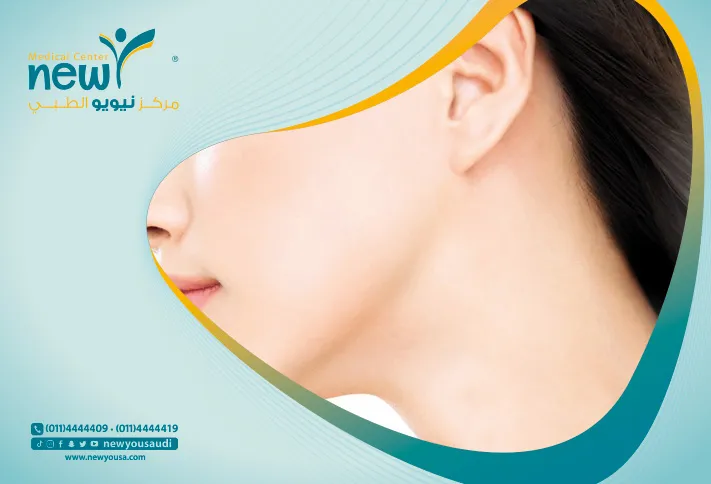 سواد الرقبة الأسباب وطرق العلاج