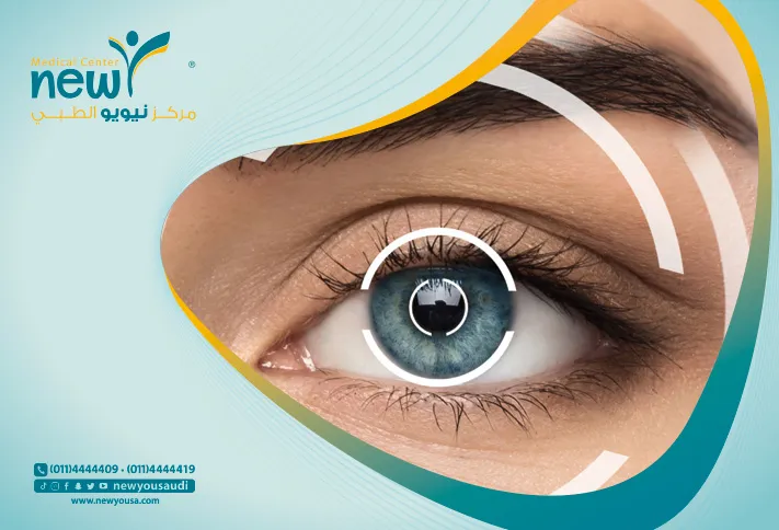 عمليات تصحيح النظر كل ما تريد معرفته عنها من خلال مركزنا الطبي في السعودية | نيويو