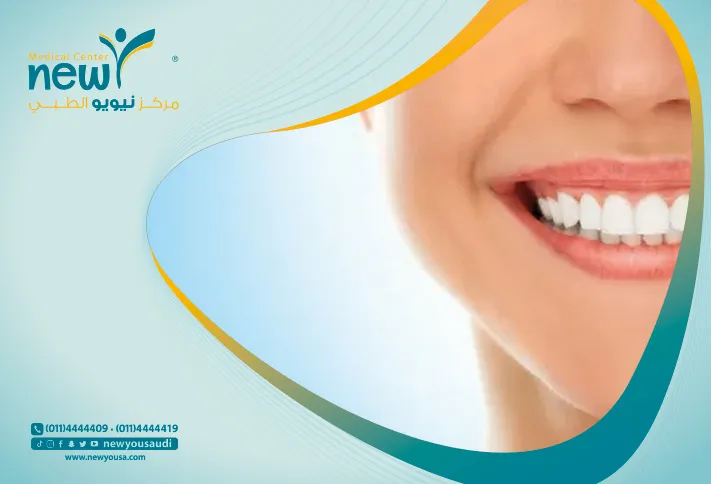الأسنان البيضاء تعرف عليه من خلال مركزنا الطبي في السعودية | نيويو