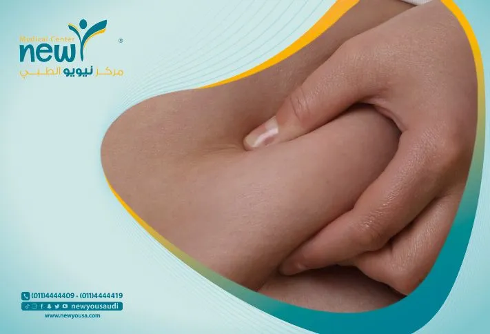 عملية كرمشة المعدة في الرياض | البروفيسور عائض القحطاني