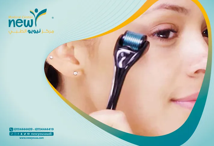 الديرما رولر كل ما تريد معرفته عنها من خلال مركزنا الطبي في السعودية | نيويو