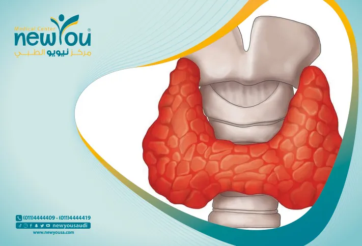 الغدة الدرقية كل ما تريد معرفته عنها من خلال مركزنا الطبي في السعودية | نيويو