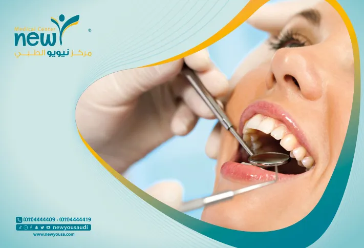 مينا الأسنان كل ما تريد معرفته عنه من خلال مركزنا الطبي في السعودية | نيويو