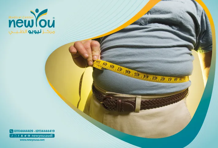 عمليات إنقاص الوزن تعرف عليه من خلال مركزنا الطبي في السعودية | نيويو