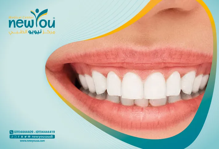 جراحة قص اللثة تعرف عليه من خلال مركزنا الطبي في السعودية | نيويو