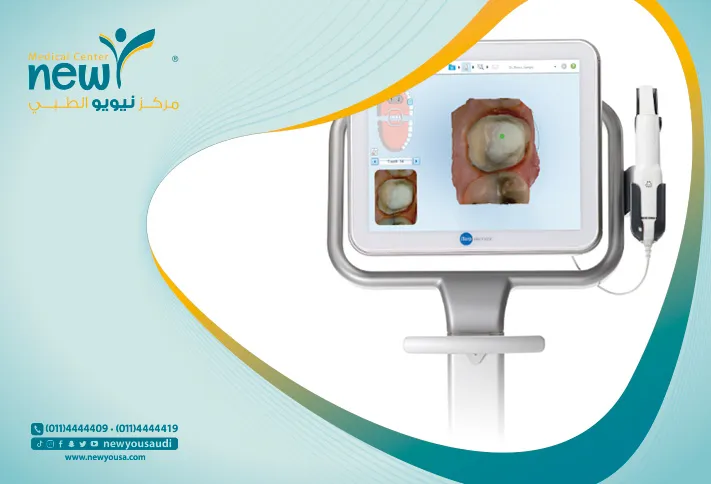 مقاسات الأسنان الرقمية