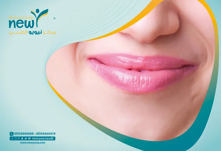 كل ما تريد معرفته عن توريد الشفايف بالليزر من خلال مركزنا الطبي في السعودية | نيويو