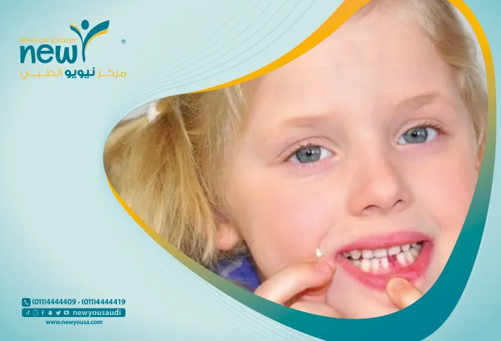 الأسنان اللبنية كل ما تريد معرفته عنها من خلال مركزنا الطبي في السعودية | نيويو