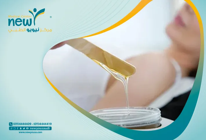 إزالة الشعر كل ما تريد معرفته عنه من خلال مركزنا الطبي في السعودية | نيويو