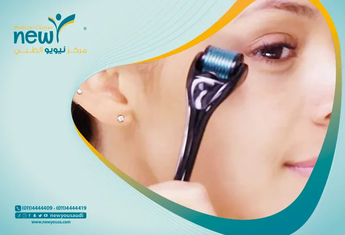 استخدام الديرما رولر و كل ما تريد معرفته عنها من خلال مركزنا الطبي في السعودية | نيويو