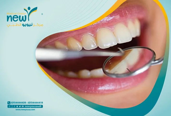تآكل مينا الأسنان كل ما تريد معرفته عنه من خلال مركزنا الطبي في السعودية | نيويو