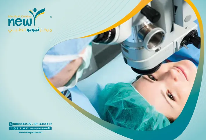 عمليات الليزك كل ما تريد معرفته عنها من خلال مركزنا الطبي في السعودية | نيويو