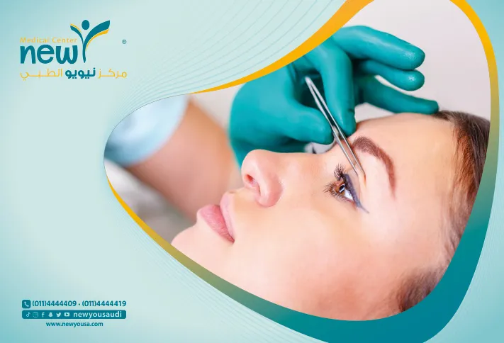 عملية رفع الجفون تعرف عليه من خلال مركزنا الطبي في السعودية | نيويو