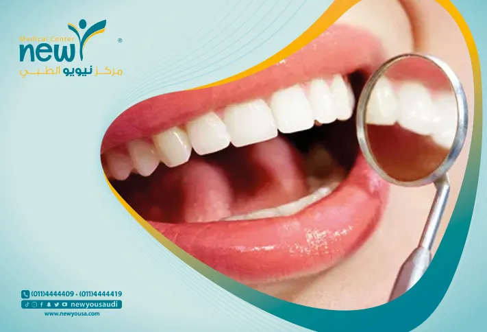 طرق علاج تعري جذور الاسنان تعرف عليها من خلال مركزنا الطبي في السعودية | نيويو