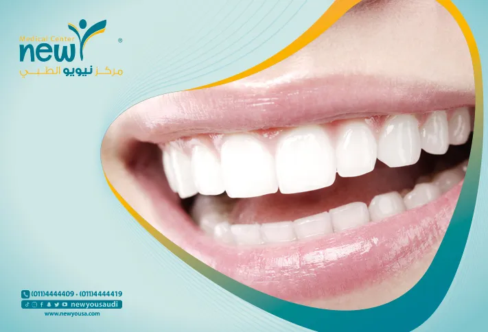 تبييض الأسنان تعرف عليه من خلال مركزنا الطبي في السعودية | نيويو
