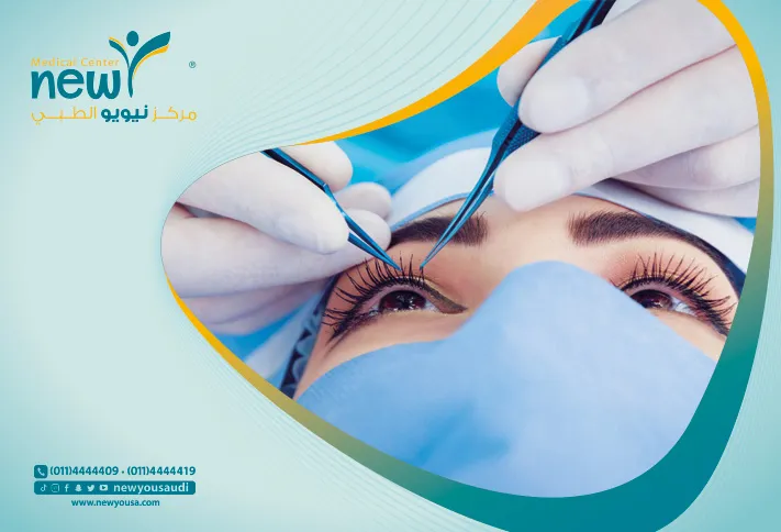 عملية توسيع العيون تعرف عليه من خلال مركزنا الطبي في السعودية | نيويو